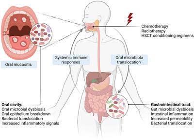Oral-Gut Microbiome Axis in the Pathogenesis of Cancer Treatment-Induced Oral Mucositis